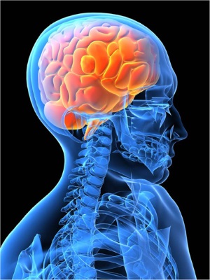 stroke1